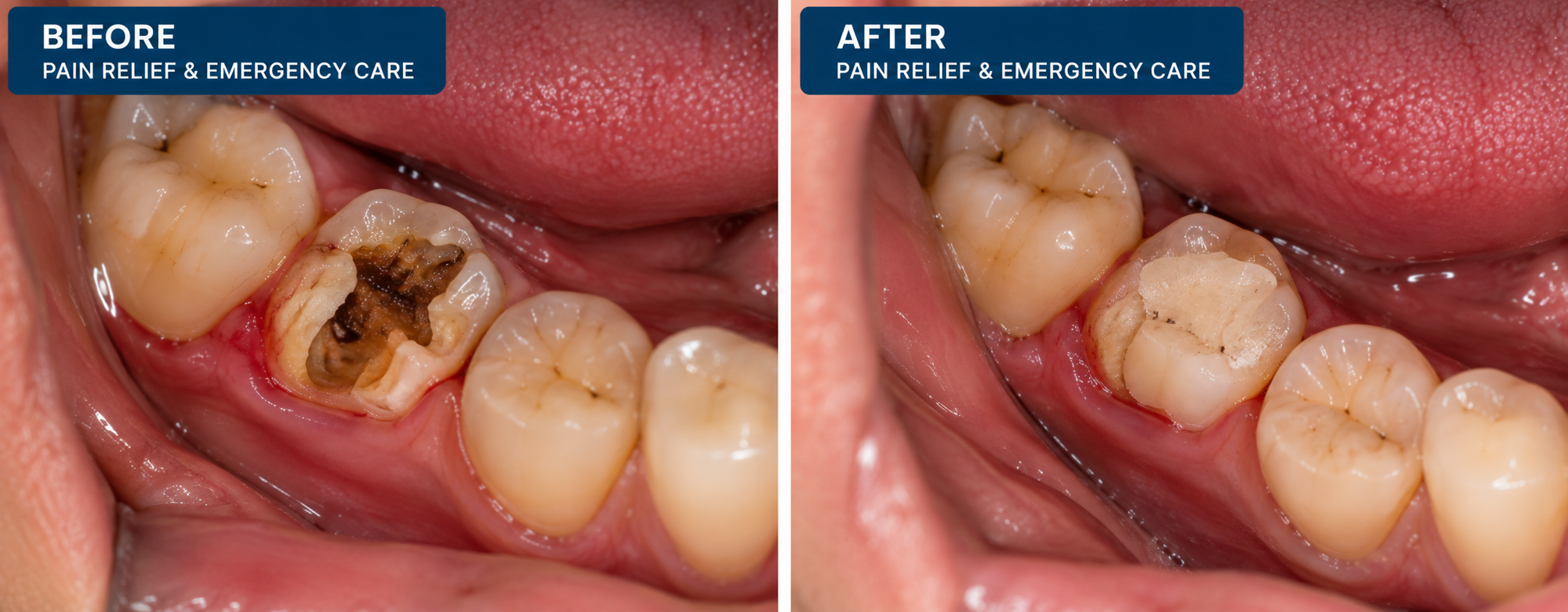 Emergency dental care and pain relief